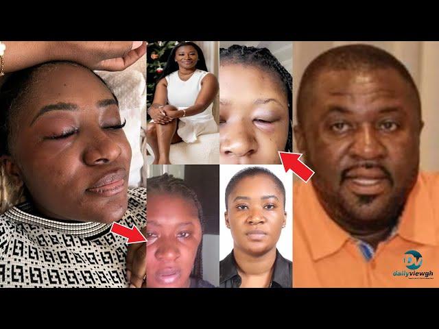 How East Legon Businessman Heαvily Beαts Girlfriend Over Child Custody - FULL STORY