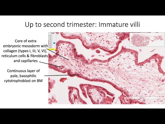 Histology with Chimmalgi: Placenta