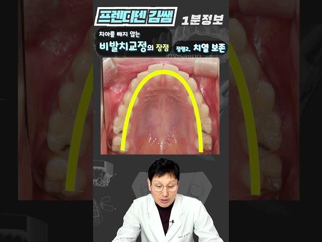 비발치교정 장점 4가지 : 치아를 안빼고 치아교정 하면 좋은 점 4가지(치열보존,교정기간,비용절감)