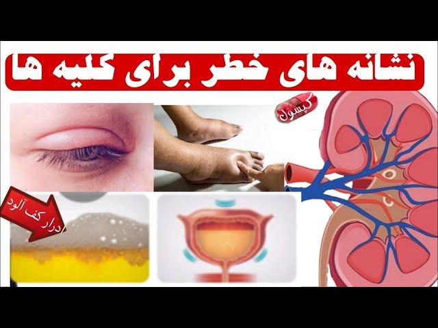 ده نشانه خطرناک که خبر از مشکلات کلیه های شما میدهد_ علائم نارسایی کلیوی