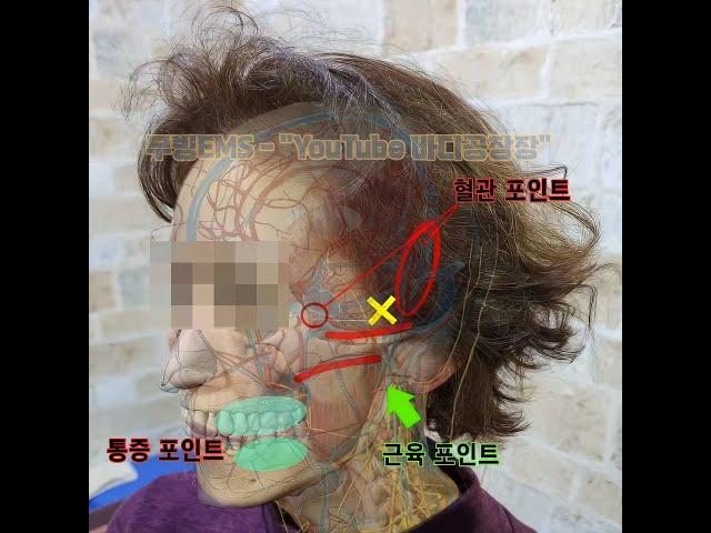 치통심할때...아픈곳이 치아가 아니야? 비정형성 치통 후기!