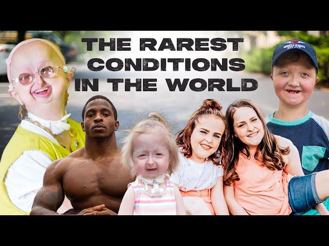 10 Of The Rarest Conditions In The World | BORN DIFFERENT