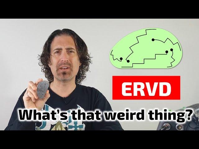 What's That Weird Thing? - ERVD Block