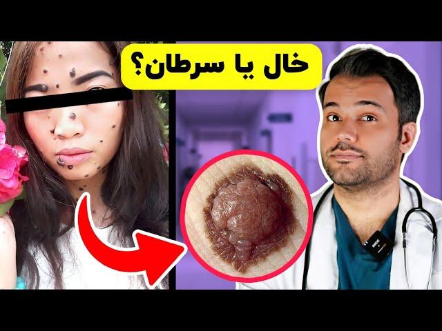 10 علامت سرطان پوست که لازمه بدونید| melanoma