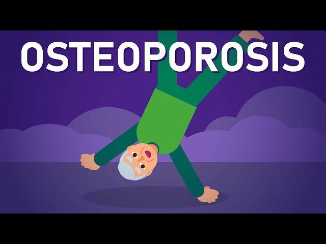 Osteoporosis: The Silent Thief of Bone Health