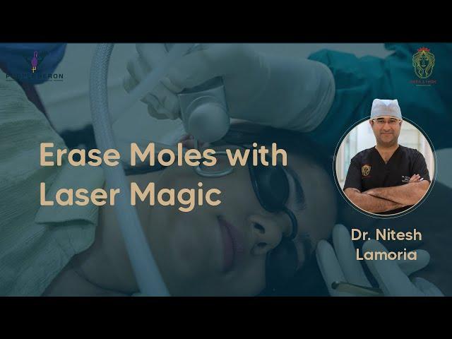 Best Laser Mole Removal Treatment || Dr Nitesh Lamoria || Purple Heron Hospital Jaipur