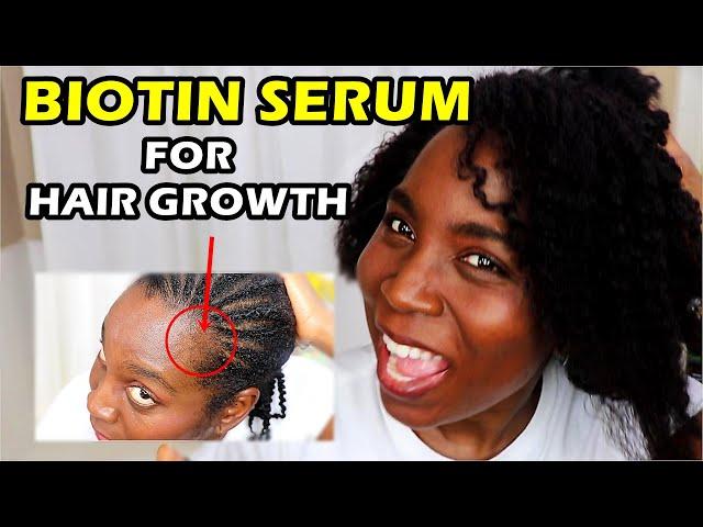 Using Biotin Serum on Scalp for Rapid Hair Growth and Thicken Hair | DiscoveringNatural