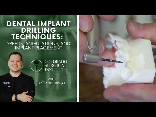 Dental Implant Drilling Techniques: Speeds, Angulations, and Implant Placement