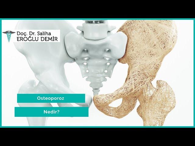 What is Osteoporosis? | How Is Osteoporosis Treated? | Osteoporosis | Assoc. Dr. Saliha Eroglu Demir