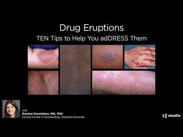 Drug Eruptions: TEN tips to help you adDRESS them