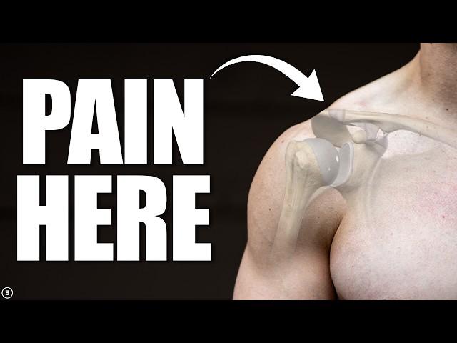 Acromioclavicular (AC) Joint Sprain | Separated Shoulder Rehab (Education & Exercises)