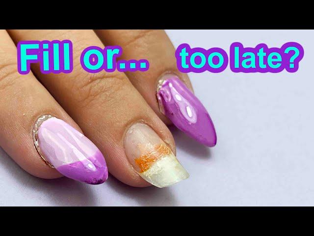 When it's too LATE for Nails Fill... Sealed Lifting, Undercured Gel & more