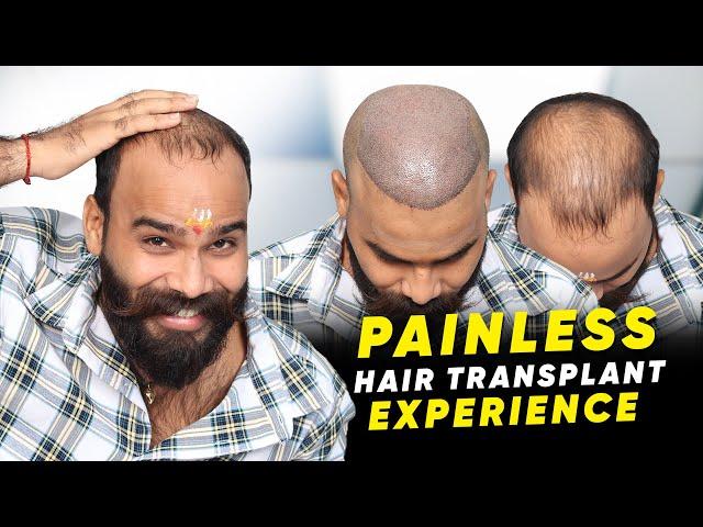 Hair Transplant in Kota | Best Results & Cost of Hair Transplant in Kota