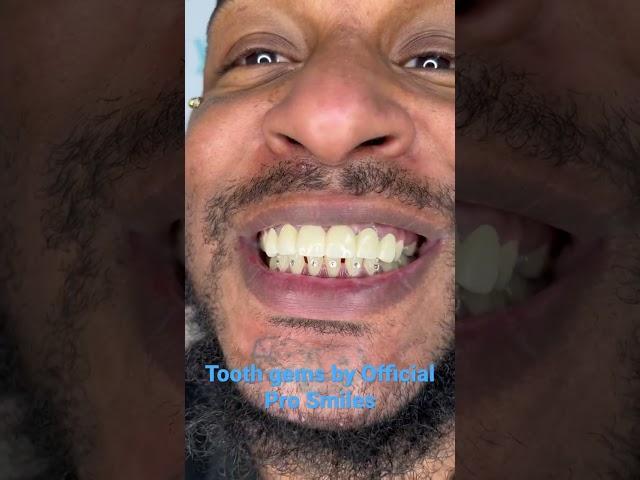 Tooth gems by official pro smiles Arizona. Tooth gem training online.