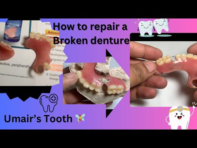 How to repair a broken denture#dental#youtube#umair tooth fairy #dentistry @Umairazeem8553