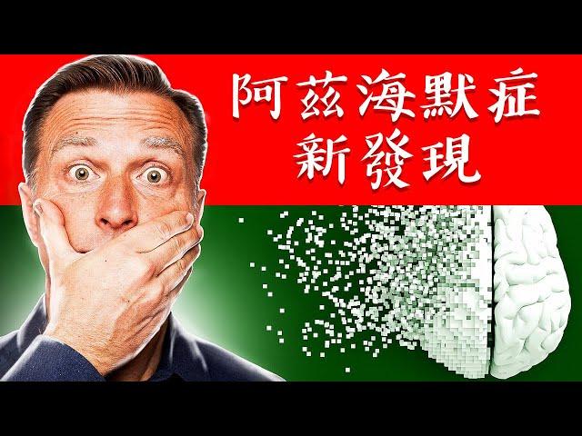 阿茲海默症的新發現,自然療法,柏格醫生 Dr Berg