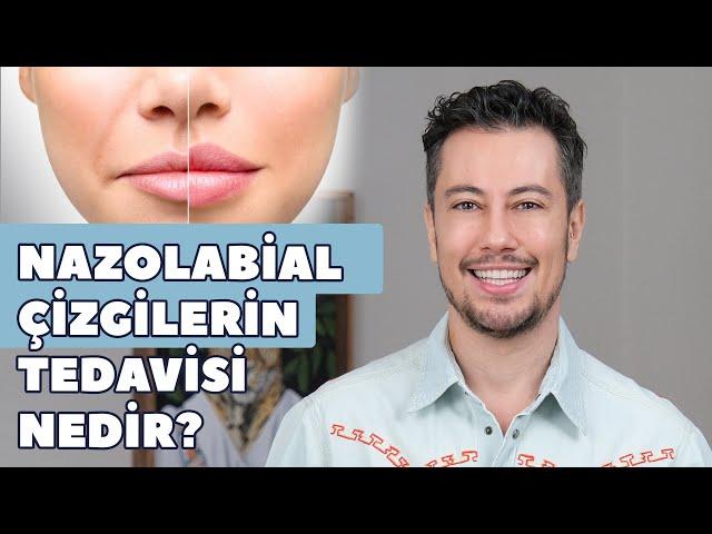 Nazolabial Çizgilerin Tedavisi Nedir?