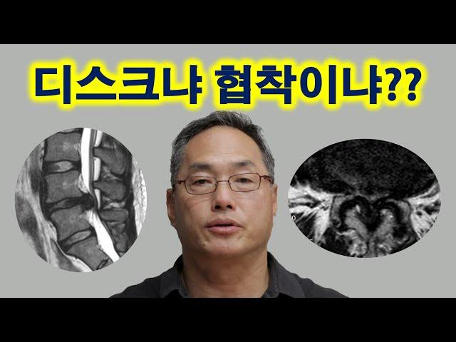 디스크냐 협착이냐