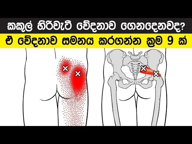 කකුල් හිරිවැටී ගෙනදෙන වේදනාව සමනය කරගන්න ක්‍රම 9 ක්