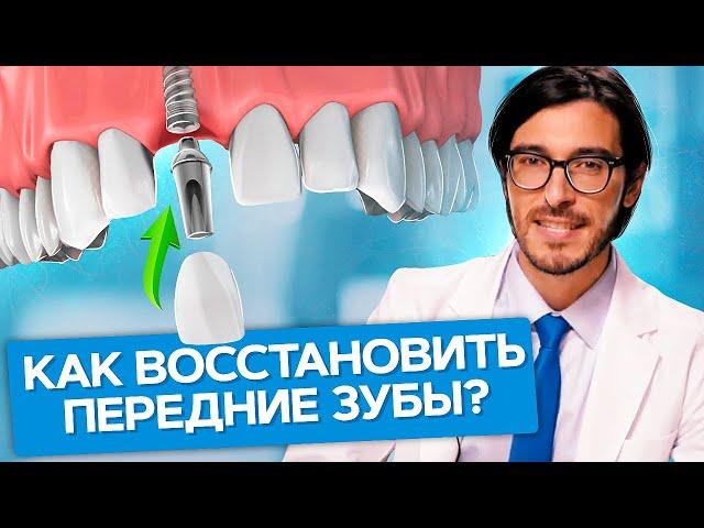 Как восстановить передние зубы? Как восстановить передние зубы с помощью имплантов и коронок?