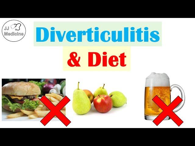 Diverticulitis & Diet | Foods & Beverages That Increase and Decrease Risk