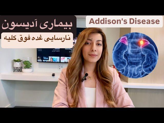 بیماری آدیسون/ نارسایی غدد فوق کلیوی/Addison's disease