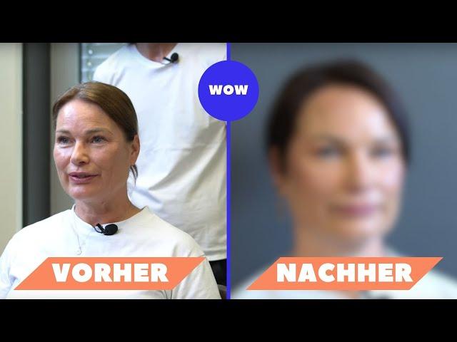 Plötzlicher Haarausfall und dünnes Haar? Dieses #vorhernachher gibt ihr neues Selbstwertgefühl