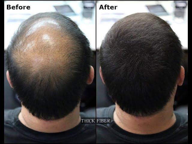 THICK FIBER |  Hair Building Fibers is a hair loss concealer fiber. Cover up Bald patches