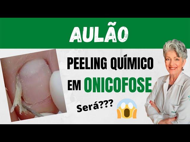 Aulão Peeling Químico em Onicofose Será que Funciona