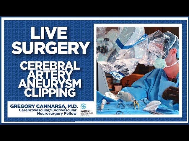 Live Surgery: Watch A Cerebral Arterial Aneurysm Clipping By Gregory Cannarsa M.D.