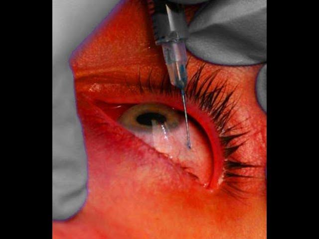 Why my tears burn my eyes