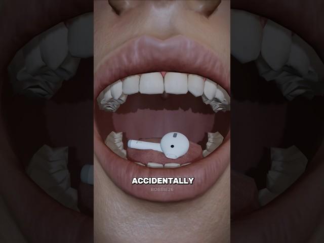 Man Swallowed Airpod And It Still Worked 