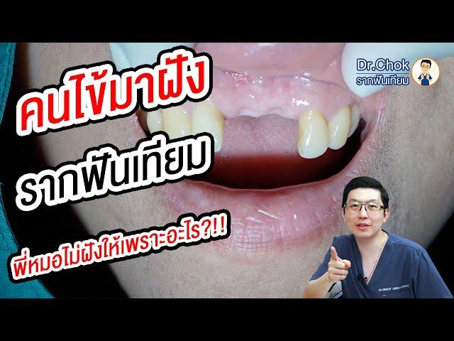 คนไข้มาฝัง รากฟันเทียมฟันหน้า แต่พี่หมอไม่ฝัง ให้เพราะอะไร ?!! | คลายปัญหารากฟันเทียมกับหมอโชค