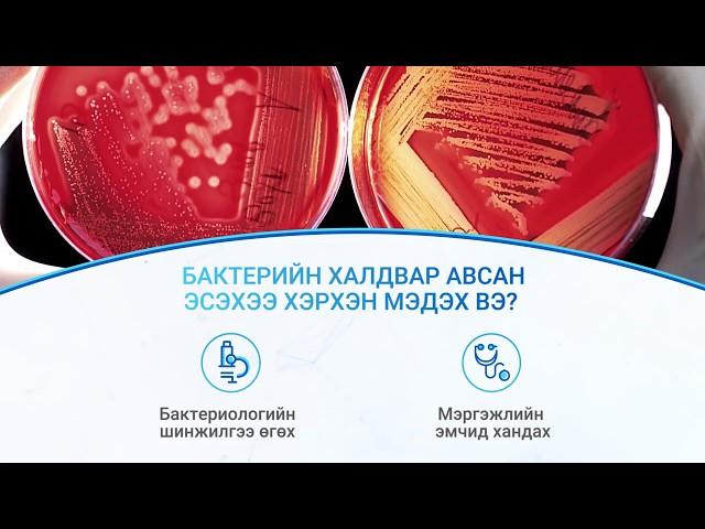 Хатиг ба MRSA халдвар