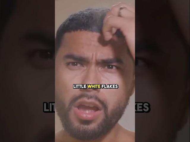 Zuniga On Wrong Shampoo?. Identify Your Scalp Type First.