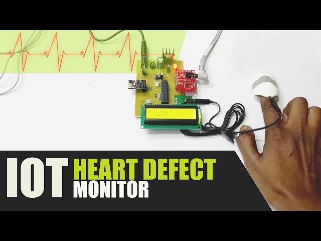 DIY IOT Based Heart Defect Monitoring System Using ECG IOT Health Project