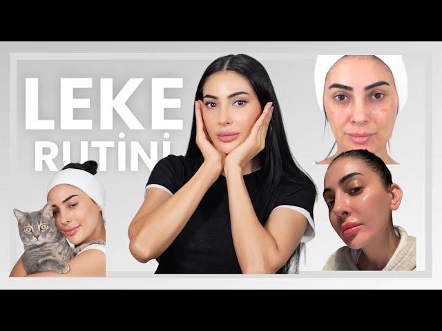 Lekelerle Nasıl Başa Çıkabiliriz? Örnek Leke Rutini