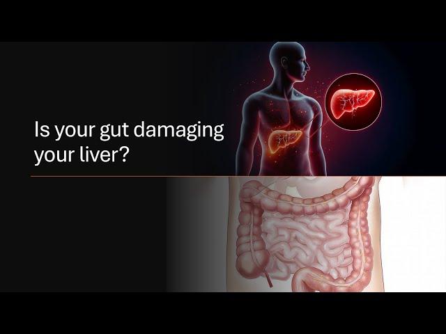 The Gut-Liver Connection: Can Probiotics Help Fight Liver Disease? | NAFLD | Fibrosis | AI plus ppt