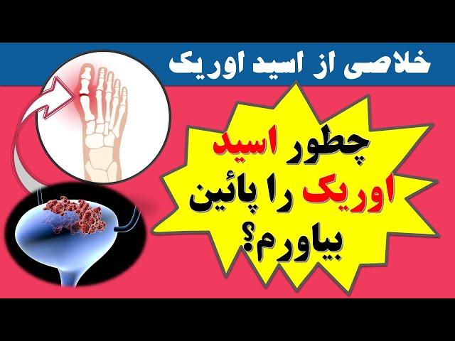 How to control uric acid چطوری اسید اوریک خون و خطر نقرس را بطور طبیعی پائین بیاورم؟