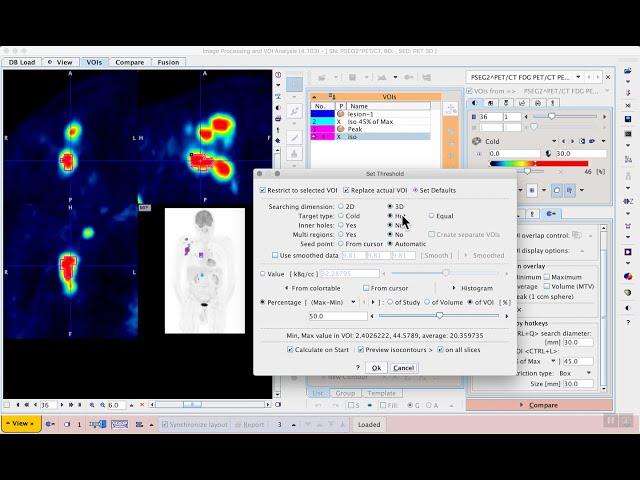 H1E7 VOI analysis