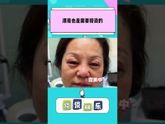当妈妈55岁微整