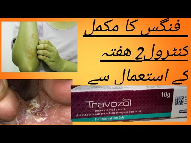 baby rashes diaper rashes kharish ka ilaj Travazol cream travocart cream/ paon phatny ka ilaj istam