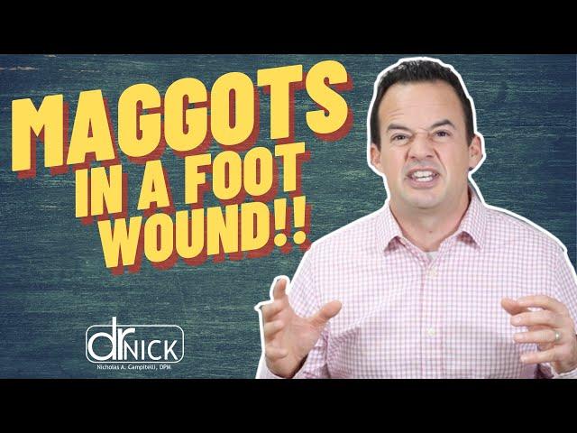 How Does a Wound Get Maggots?! | Dr. Nick Campitelli