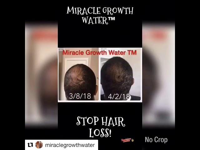 STOP HAIR LOSS GROW HAIR FAST MIRACLE GROWTH WATER™️