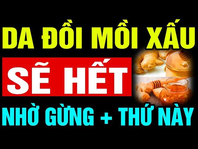 BS Mách: DA ĐỒI MỒI TÀN NHANG KHÓ SỐNG THỌ, CÓ CÔNG THỨC GỪNG MẬT ONG NÀY VỀ GIÀ TRẺ KHỎE THỌ