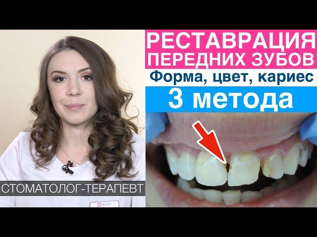 Передние зубы - как реставрируются. Пломба, виниры, композитные виниры