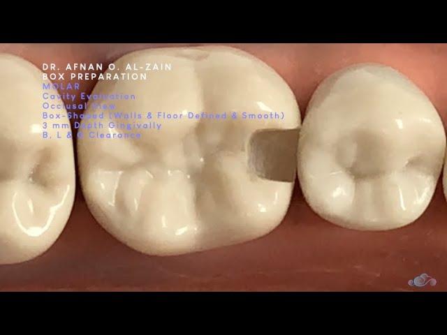 Box cavity preparation for composite restoration on a molar (#36) - Arabic عربي