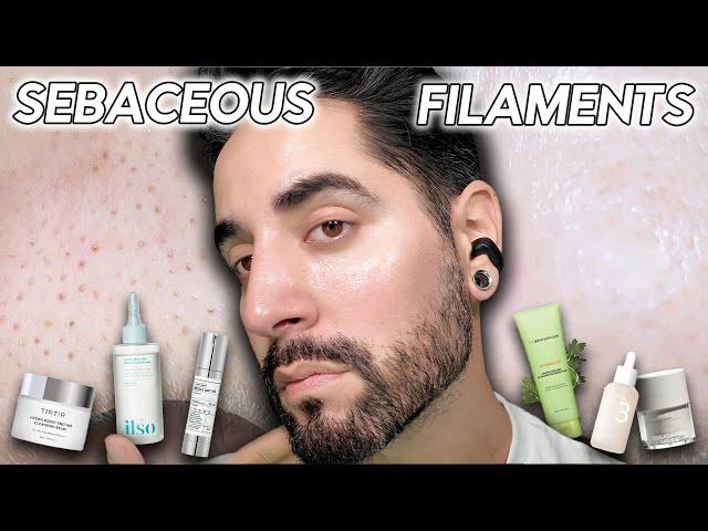 How I Get Rid Of Sebaceous Filaments & Congested Pores