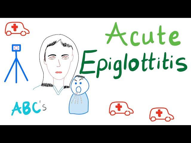 Acute Epiglottitis | Causes, Symptoms, Diagnosis and Management