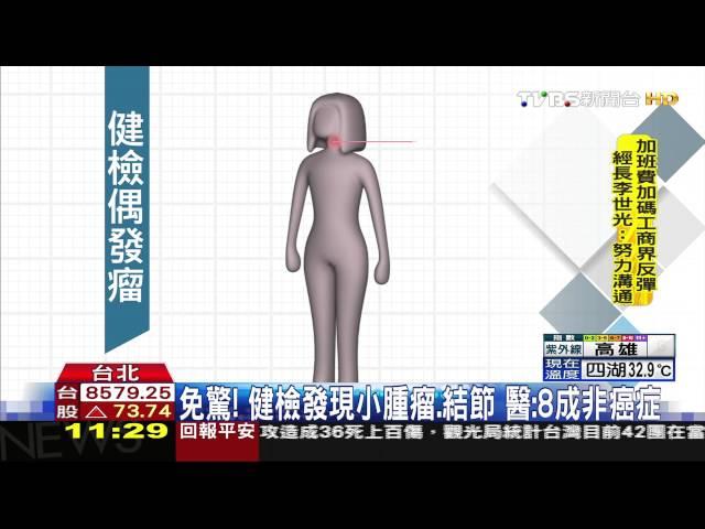 【TVBS】免驚！健檢發現小腫瘤、結節　醫：8成非癌症